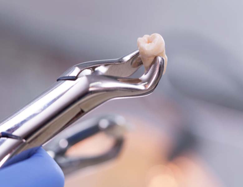 柏市・我孫子市の訪問歯科、すえいし歯科矯正歯科 歯科訪問部の訪問歯科