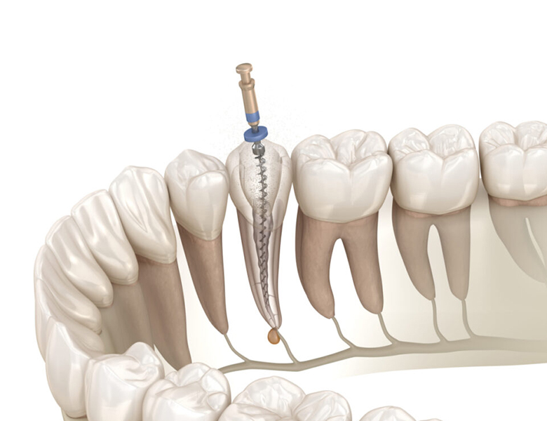 柏市・我孫子市の訪問歯科、すえいし歯科矯正歯科 歯科訪問部の訪問歯科