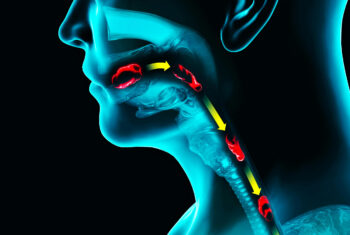 柏市・我孫子市の訪問歯科、すえいし歯科矯正歯科 歯科訪問部の誤嚥性肺炎の予防