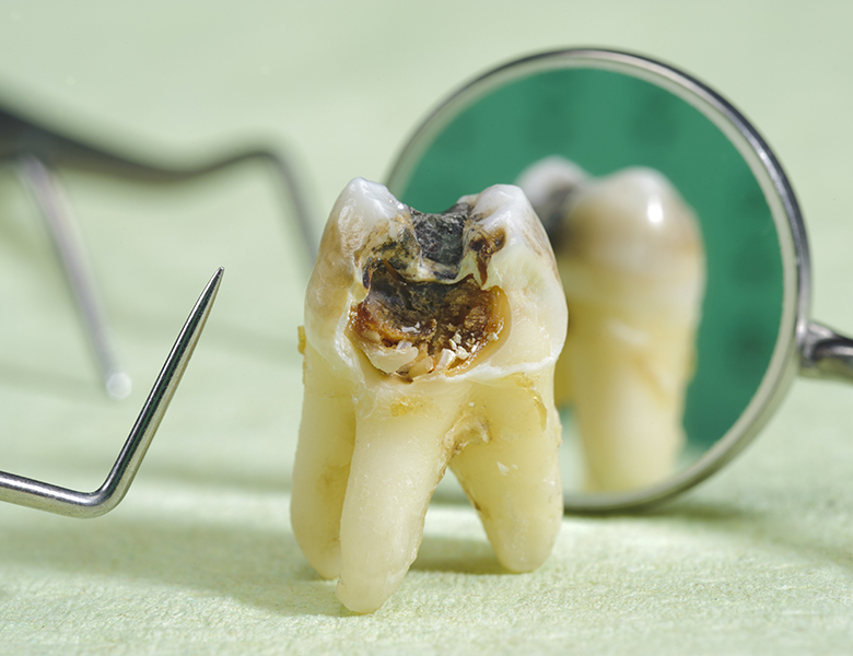 柏市・我孫子市の訪問歯科、すえいし歯科矯正歯科 歯科訪問部の訪問歯科